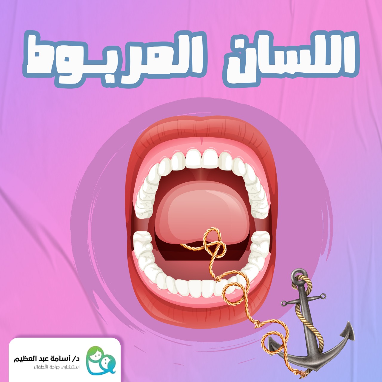 التصاق اللسان (اللسان المربوط) - الأعراض والأسباب - د. أسامة عبد العظيم